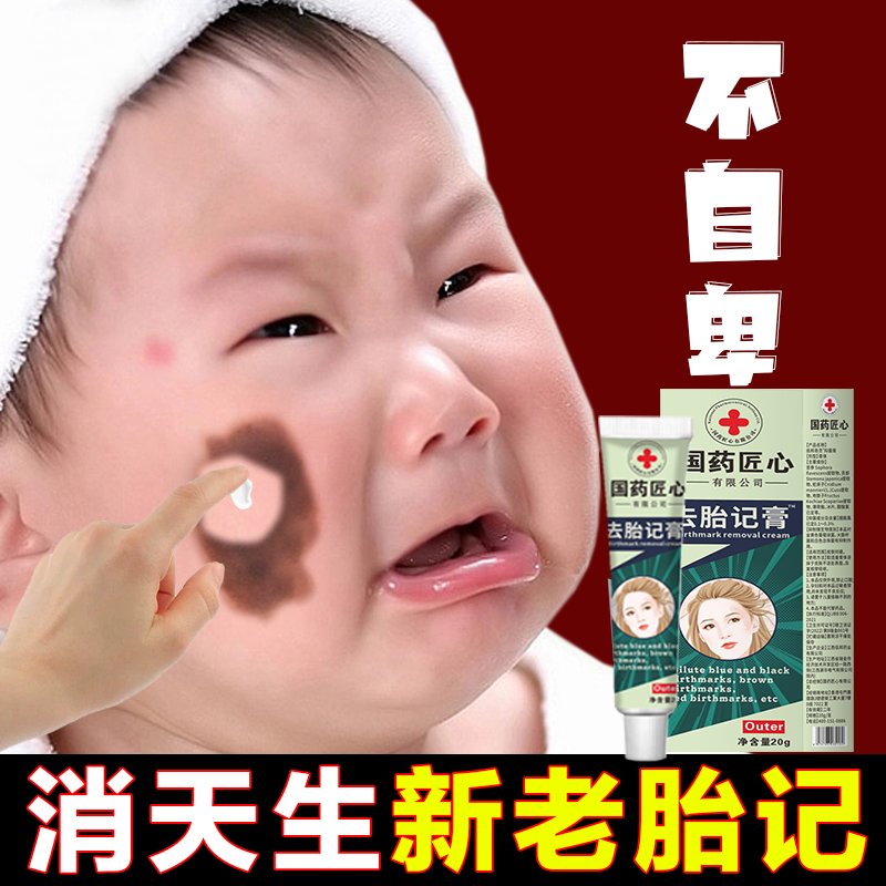 24岁左右去除胎记的最佳年龄是几岁？