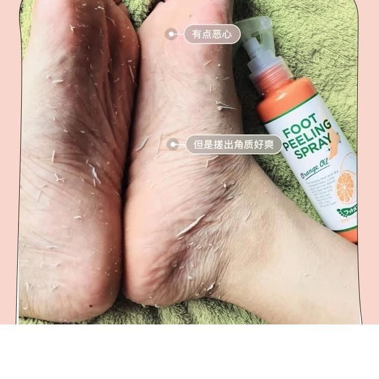 日本Footmedi足部去角质喷雾：脚后跟老茧死皮的终结者，神器来了！