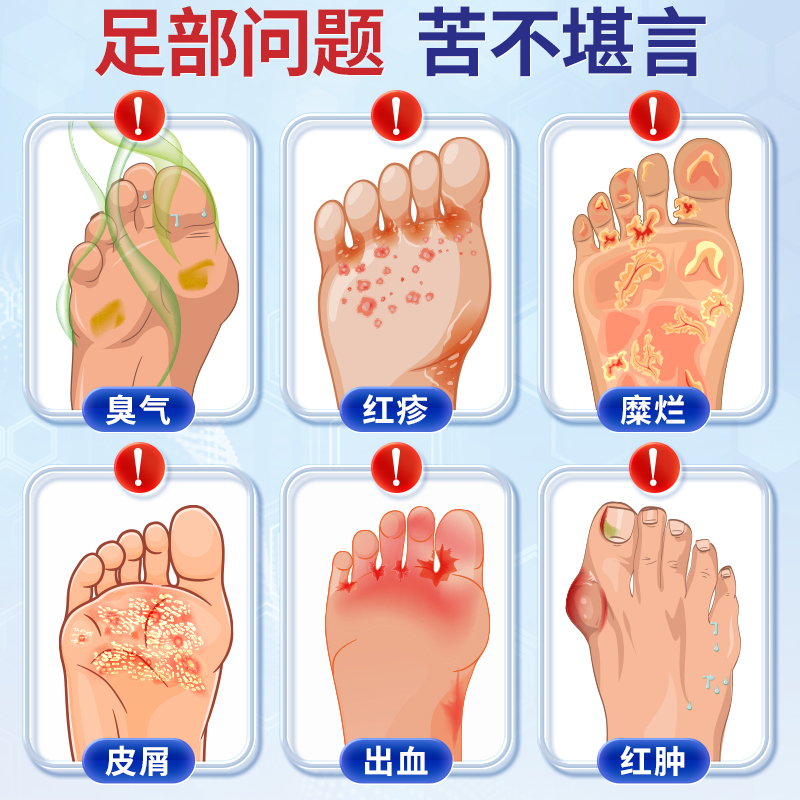 足爽佳和·花安乐抑菌喷剂：告别脚臭，轻松享受夏日清爽!