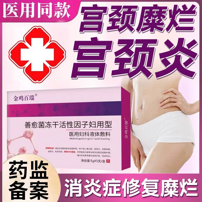 卡波姆妇科凝胶：女性私处修复神器，告别炎症困扰！