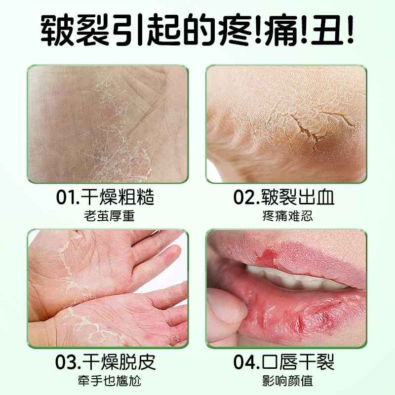 皮肤粗糙是什么原因导致的？如何改善？