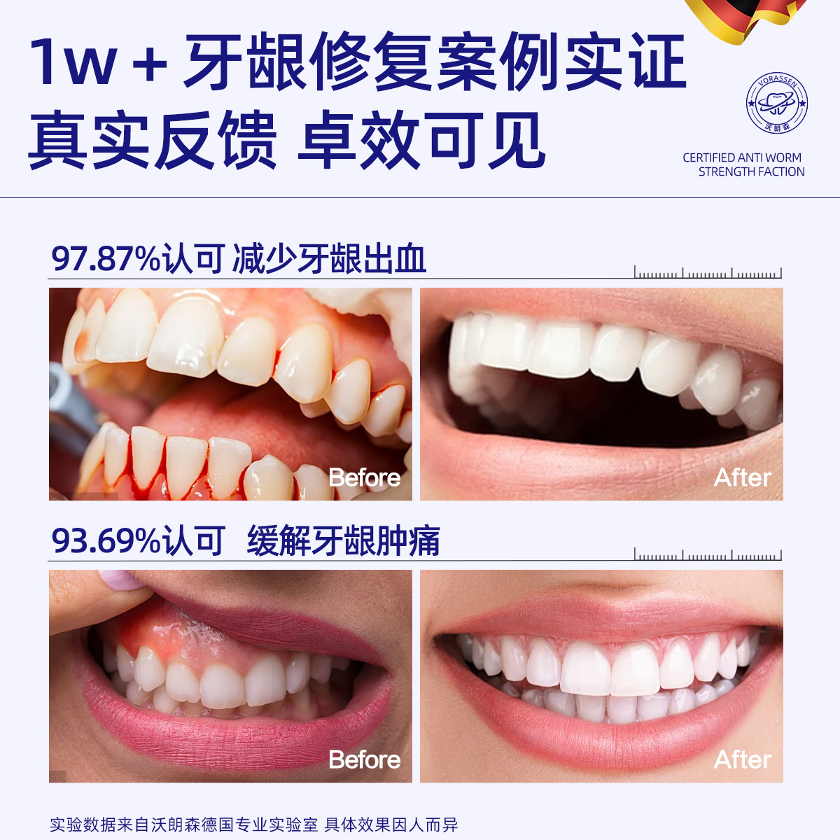 沃朗森牙科分离剂真的能治牙周炎？抗敏去结石口臭全搞定！这波必须冲！