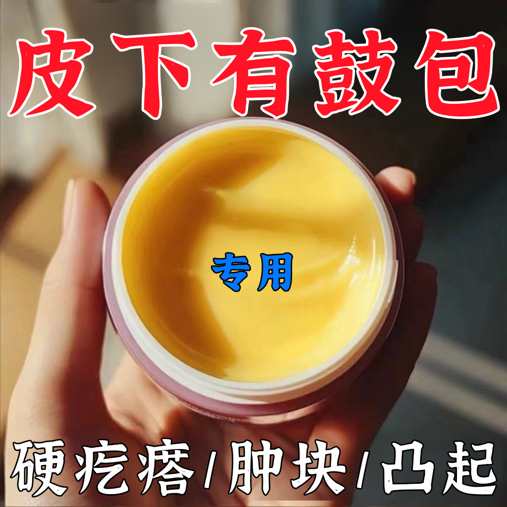 香港脂肪康正品肿块膏：解决皮下硬块的秘密武器，你还在犹豫什么？