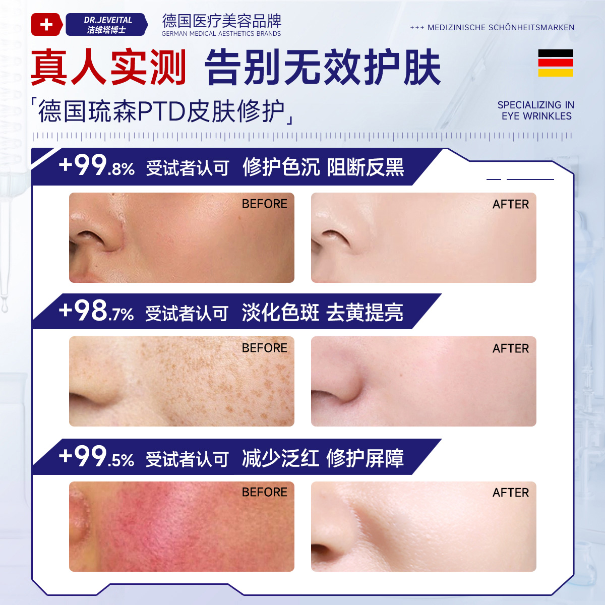 40岁女人脸上长黄褐斑怎么办？宝藏护肤指南，建议收藏！