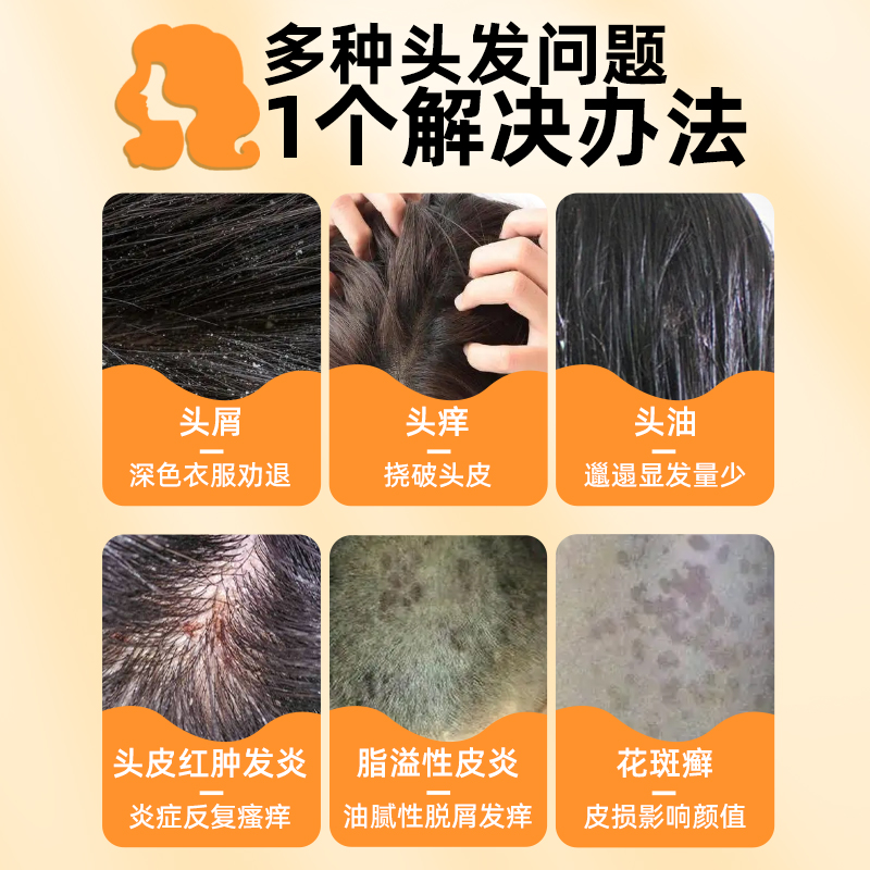 医用官方旗舰店二硫化硒洗剂：告别头皮烦恼，重塑清爽秀发！