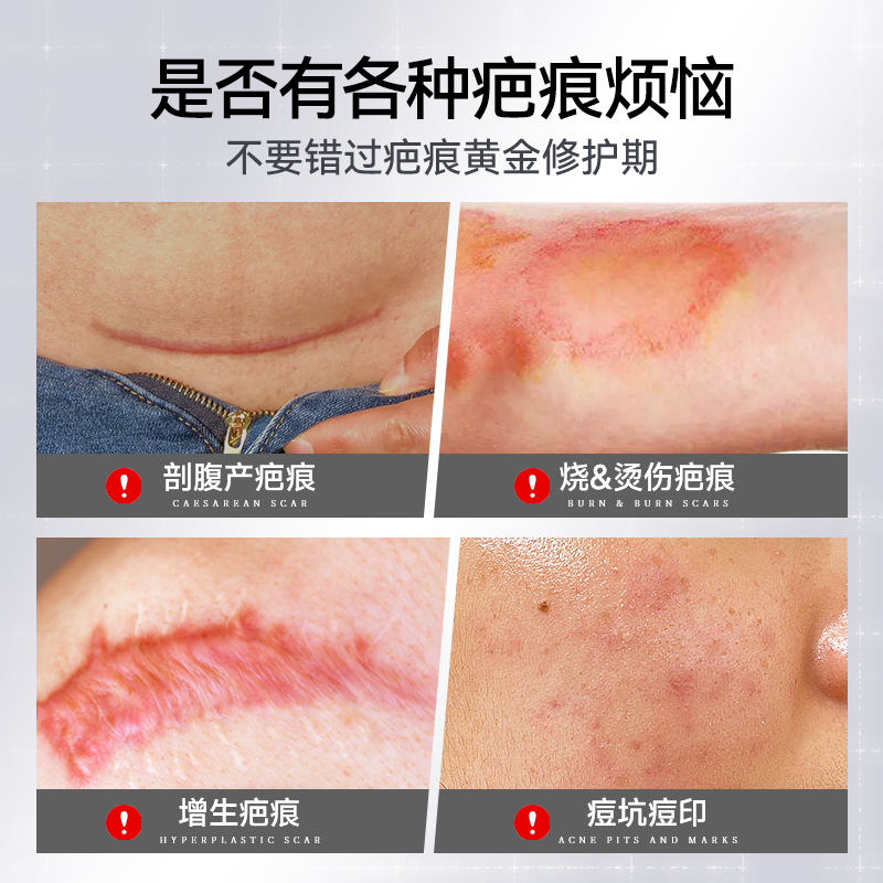 剖腹产的那些事儿，小白必看！教科书般的知识，让你秒变专家！‍⚕️