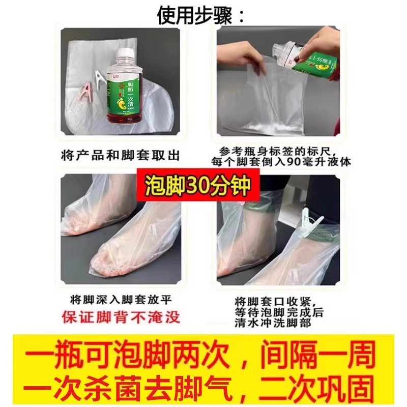 脚癣克星！一次净脚气去根特效药，告别瘙痒脱皮烦恼