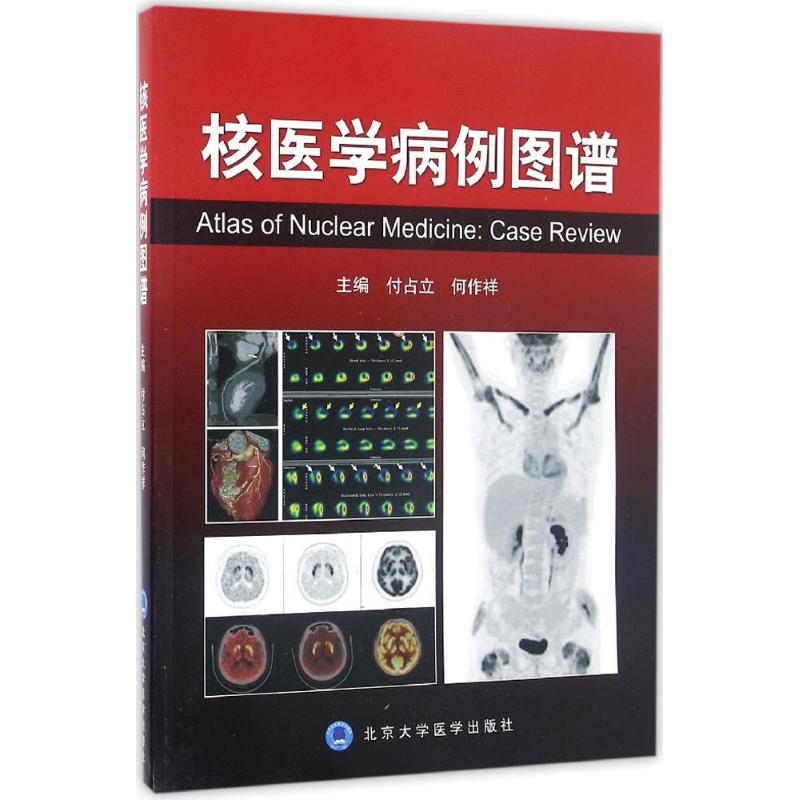 核医学病例图谱：医学探索者的必备神器，揭秘人体奥秘！