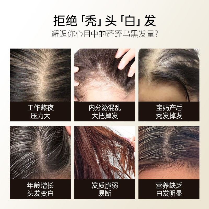 2件起购爱珂丝黑金版毛毛饮水溶性硅元素乌黑秀发，让你的头发焕发新生！✨