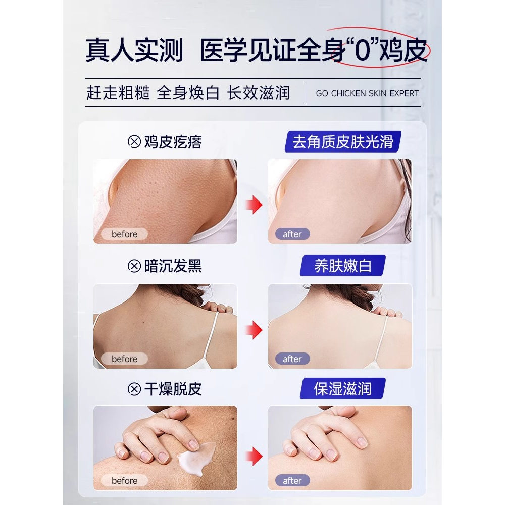 韩国原装进口伊耐森磨砂膏：告别鸡皮，重拾光滑肌肤的秘密武器！