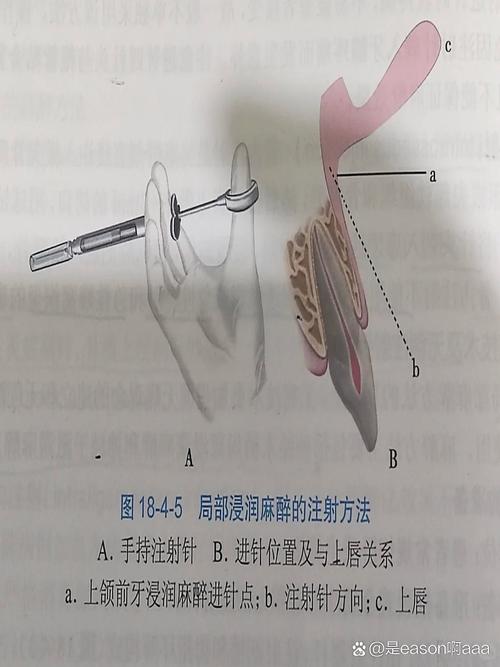 女生适合学麻醉专业吗,职业前景与挑战并存-第2张图片-职教招生网