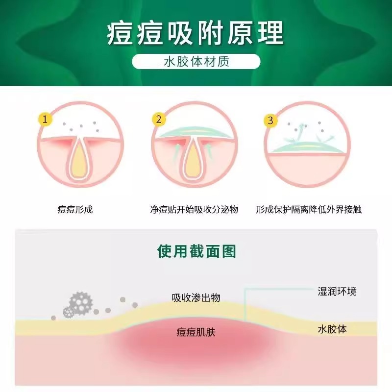 祛痘去痘印最快最有效的方法是什么？