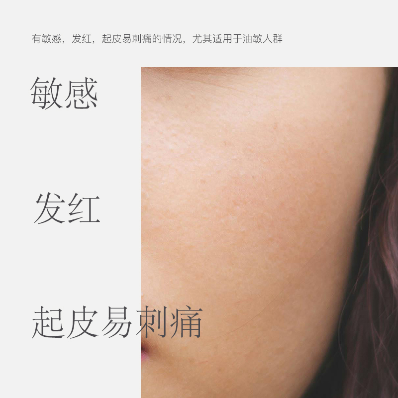 有北舒缓懒精灵面膜youbello温和乳液面膜两用，懒人必备神器！