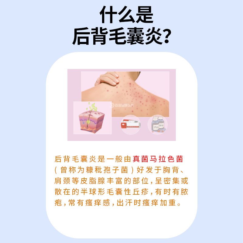 背部毛孔粗大的原因有哪些？背后隐藏的秘密