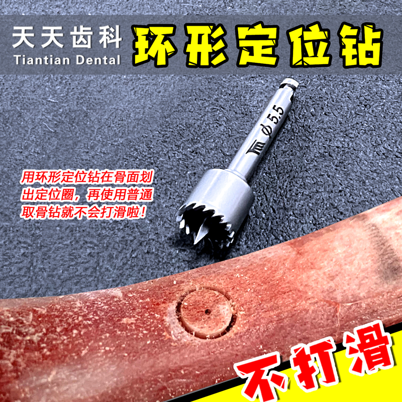 牙科种植取骨环形定位钻：精准取骨不打滑，新手也能稳如老司机！