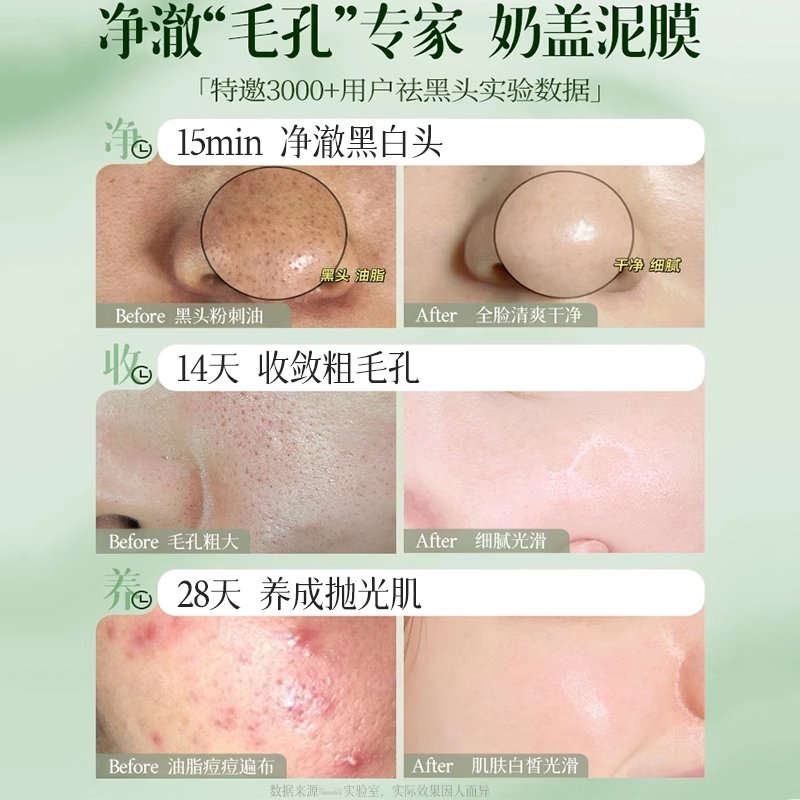MREA黑头棒+水杨壬二酸清洁泥膜：告别草莓鼻，毛孔也能呼吸！✨