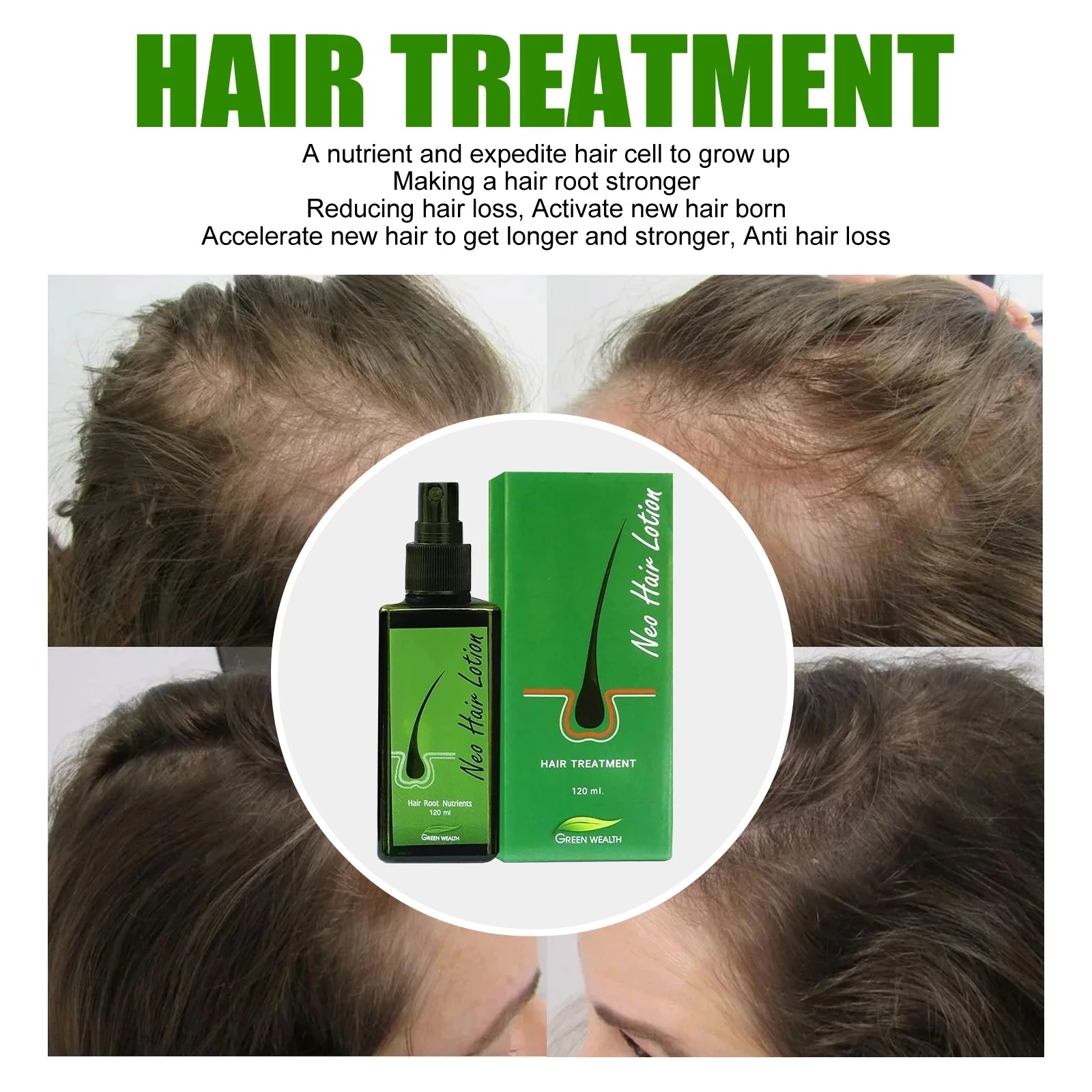 1pc Original NEO Hair Growth Lotion Spray: 拯救秃头星人的终极秘籍