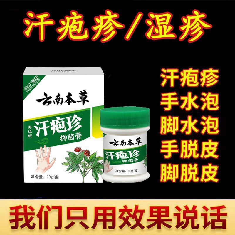 云南真菌王手上起小水泡？止痒膏汗疱疹药膏全攻略，告别手痒瘙痒真菌感染！