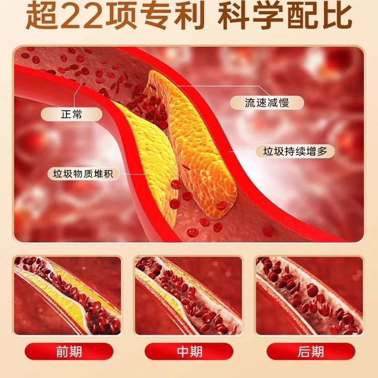 DDZ德国进口水蛭素小分子肽纳豆激酶辅酶：守护中老年人心脑血管健康的秘密武器！