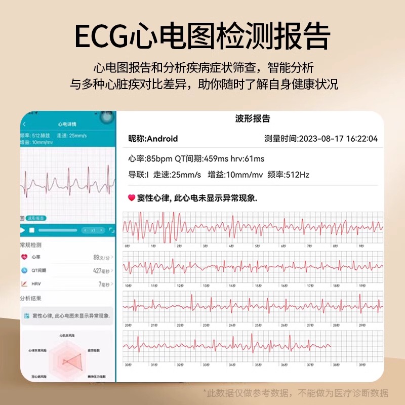 如何挑选最适合你的智能手表？小白必看，绝绝子的选购指南！
