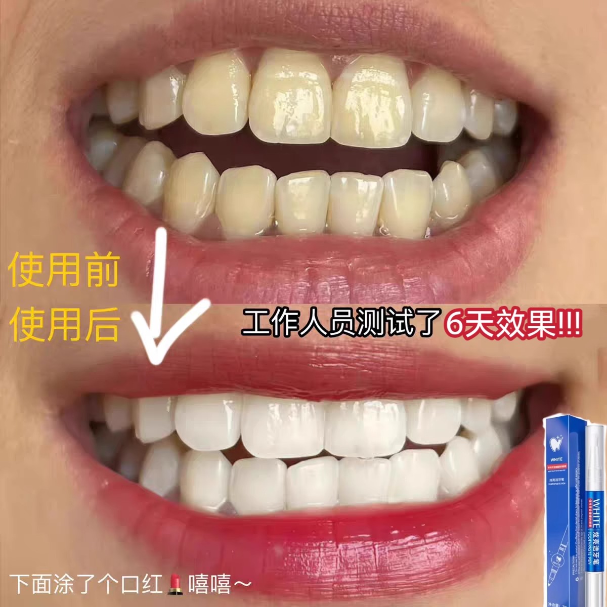 茶渍救星！牙科护理笔，轻松告别茶渍困扰