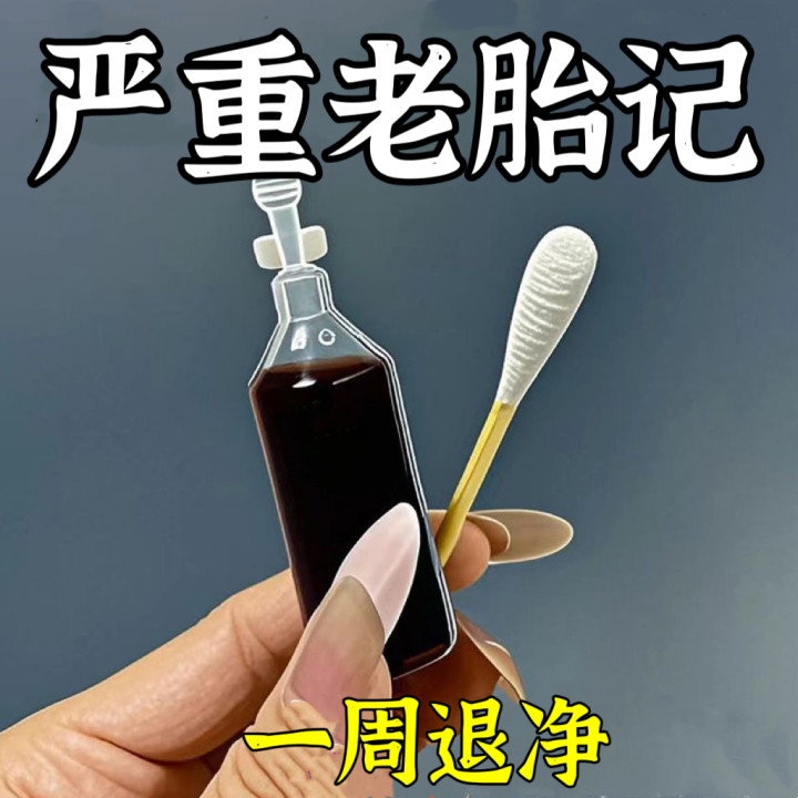 全国最好的胎记医院是哪家？如何选择适合的治疗机构？