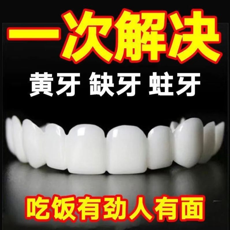 门牙贴片临时牙套：瞬间变美，告别牙齿烦恼！