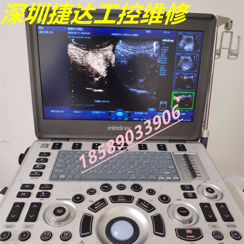 B超显示早孕是什么意思？手把手教你读懂B超报告，绝绝子的怀孕科普来了！