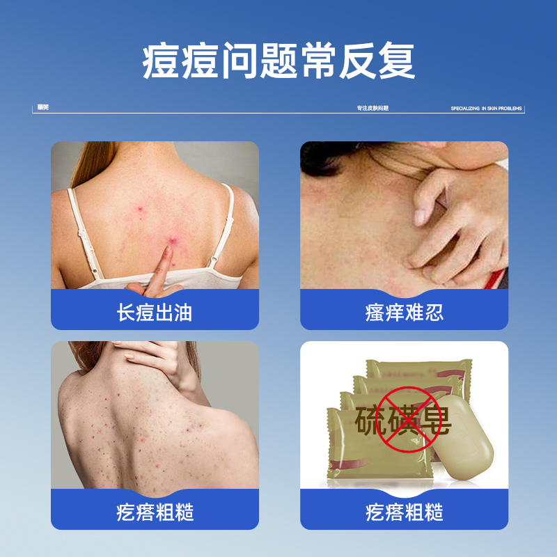 程十安的店Q+A苹果酸面膜：去角质控油洁面新宠，敏感肌也能安心用？