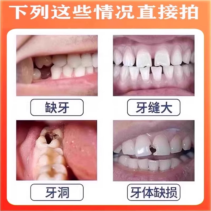 告别牙齿虫洞，固齿神器，效果太好！无效包退，牙齿黑窟窿不再是难题！