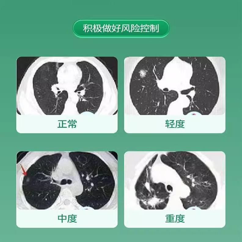 戒烟神器：清烟含片，告别烟瘾的清凉薄荷糖！
