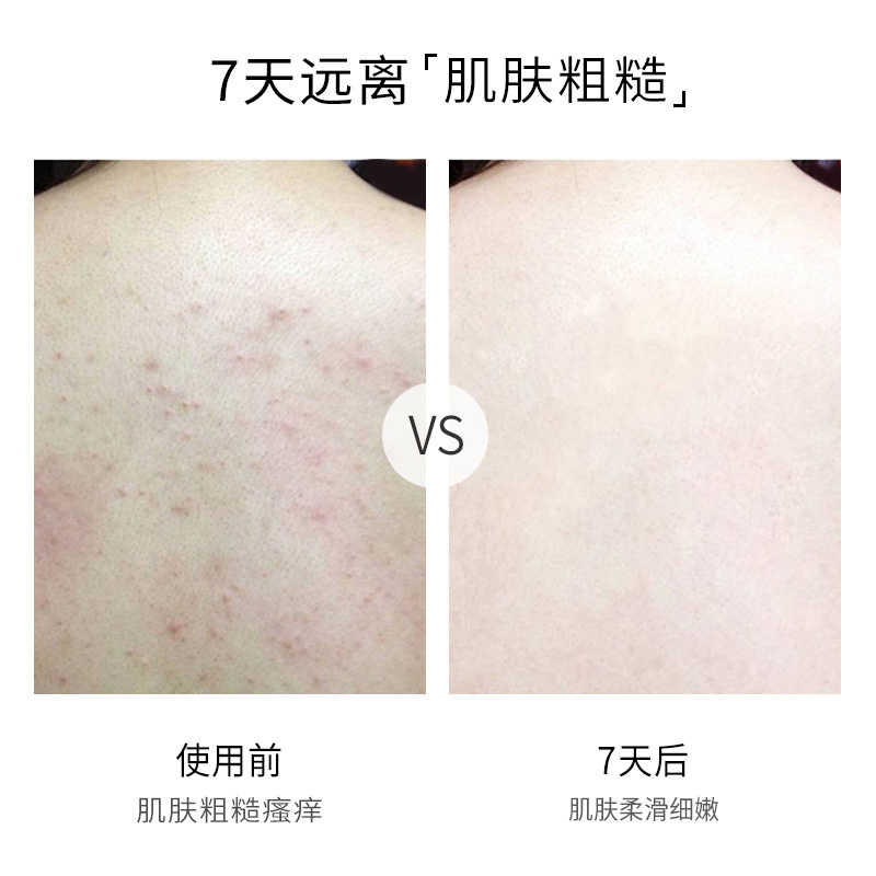 正品以色列进口死海盐浴盐，去鸡皮肤去角质，泡澡必备神器！✨