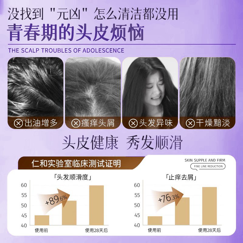 净町益生元洗发水：控油保湿新宠，让你的秀发告别屑屑烦恼！✨