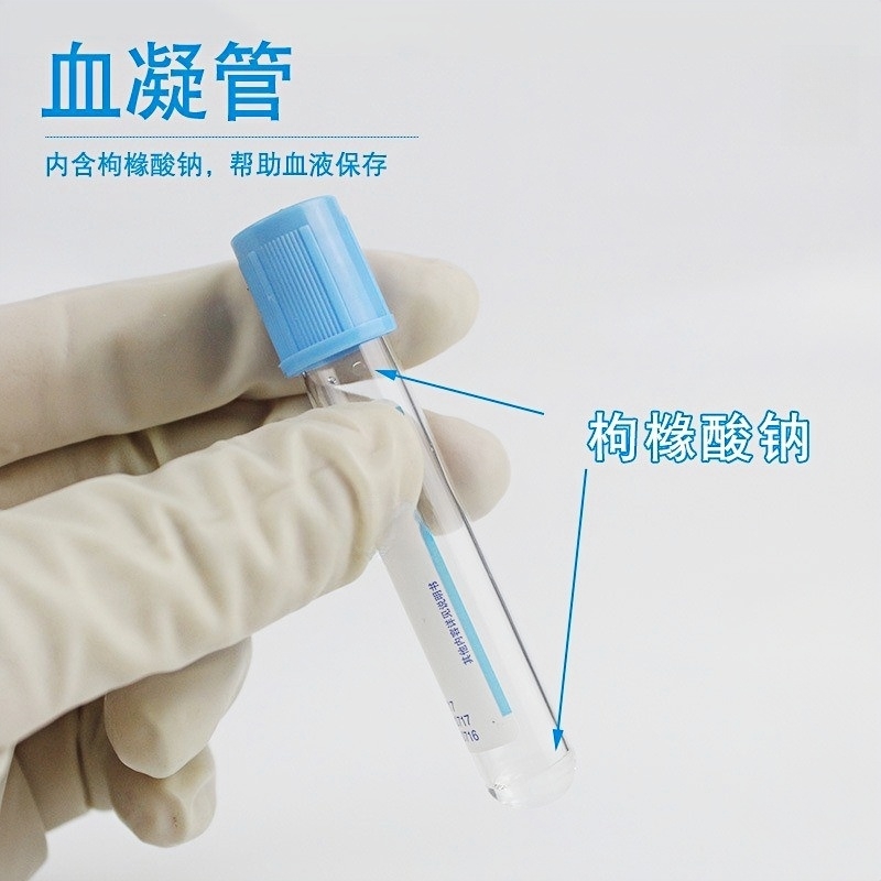 康卫仕血凝管1:9枸橼酸钠，一次性使用的10ml玻璃采血管，揭秘它的神奇之处！