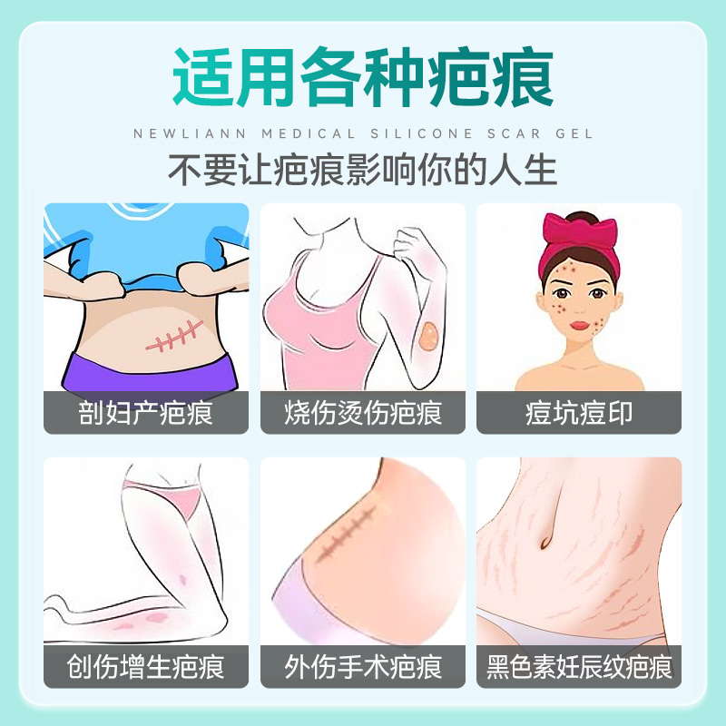 韩国朴美祛疤凝胶：剖腹产术后疤痕修复神器，告别疙瘩与凸起！