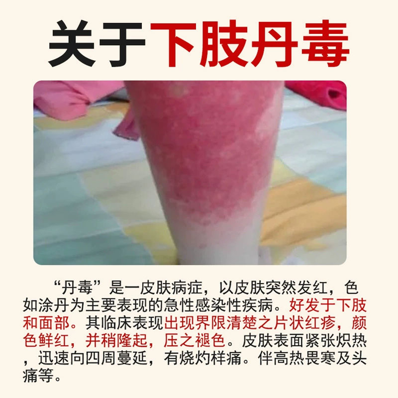 治疗丹毒症、肢血管炎、皮下出血、紫瘀斑、屑病、色素过敏皮炎的终极药膏大揭秘！