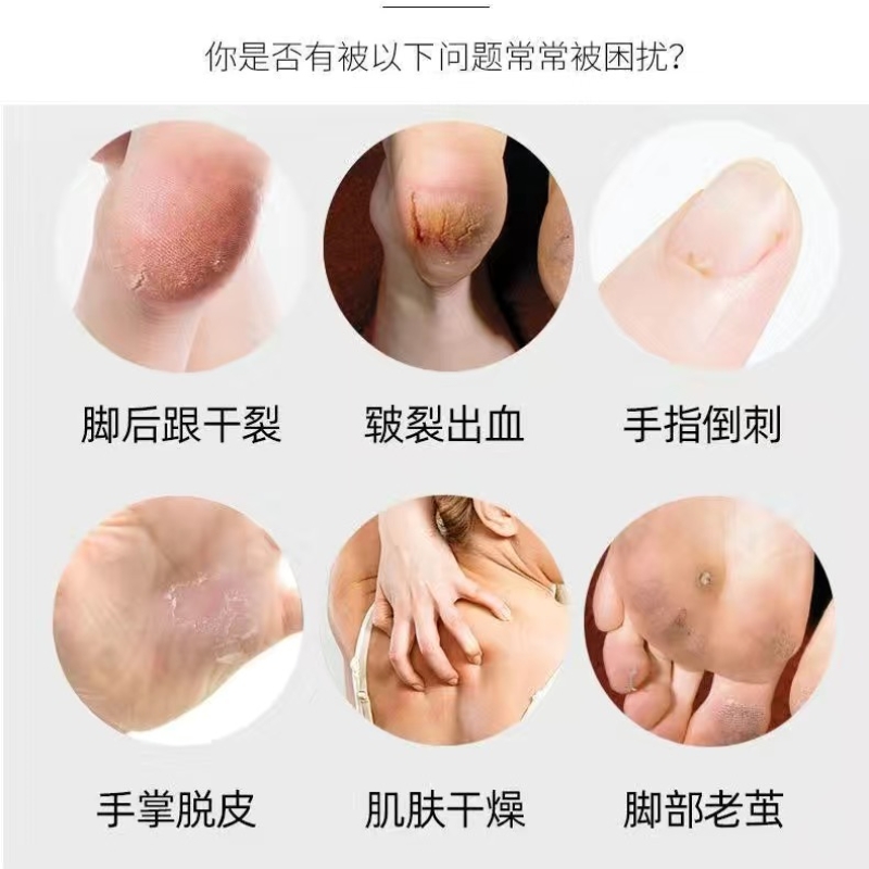 润手油可以抹脸吗？女生们注意啦！