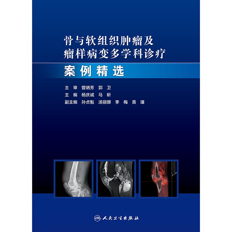 骨与软组织肿瘤诊疗圣经，医学界必备神器！
