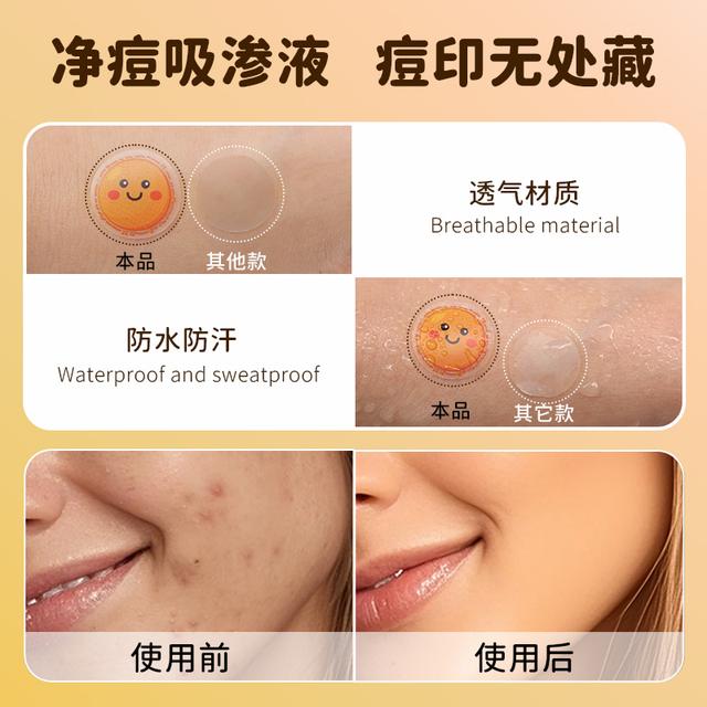AUSLKA痘痘贴香橙味：女生必备的祛痘神器，轻薄防水透温还能温和舒缓！