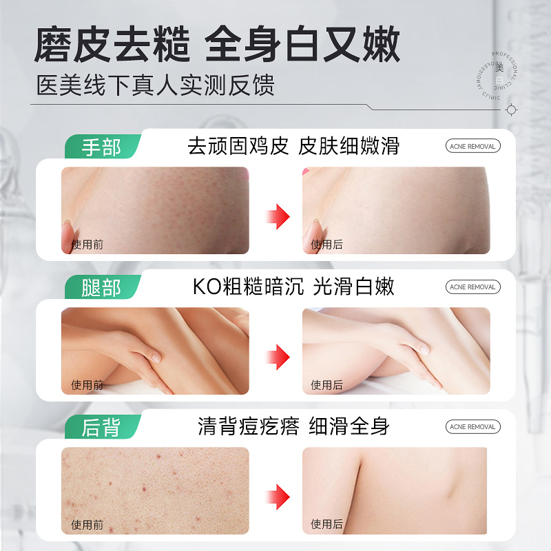 明星都在用的牛油果磨砂膏身体乳嫩白全身去角质去鸡皮沐浴露三合一，美白嫩肤的秘密武器！