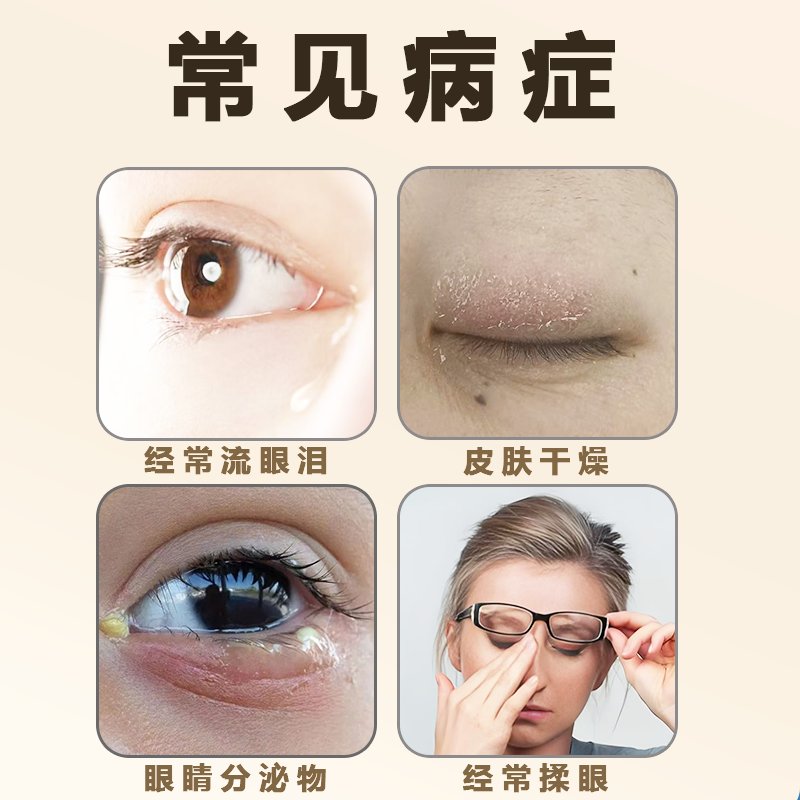 眼角干裂起皮？神经性皮炎+结膜炎救星！MF神器测评太香了