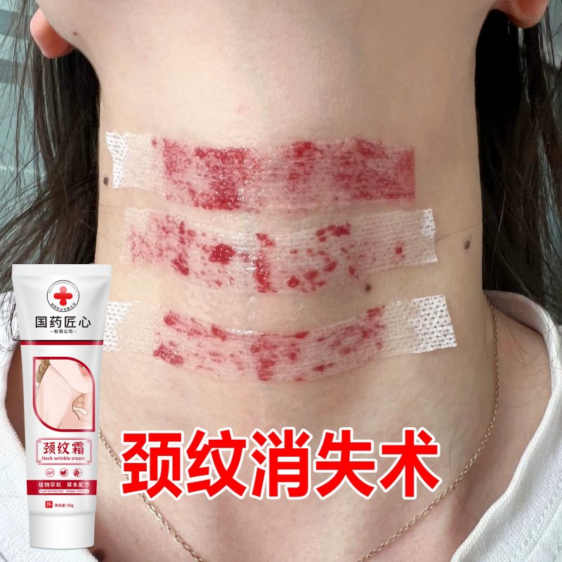 ✨妊娠纹的治疗范围，姐妹们快来看看哪些方法好用到哭！