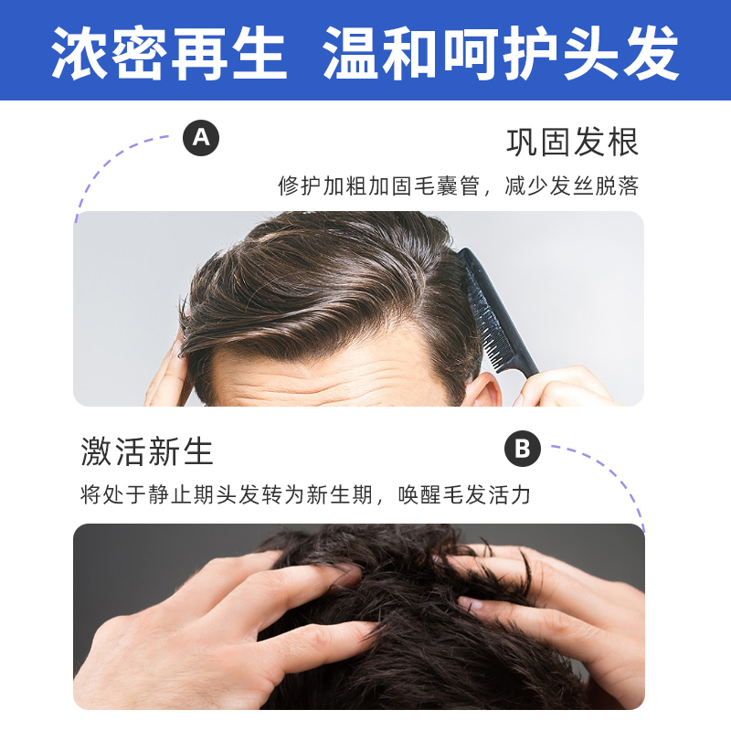 柯克兰生发液测评：真的能救我秃头吗？