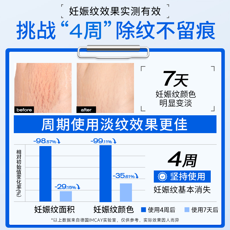 德国进口妊娠纹修复霜：准孕妇专用，孕期预防+产后淡化，告别妊娠纹不再是梦！
