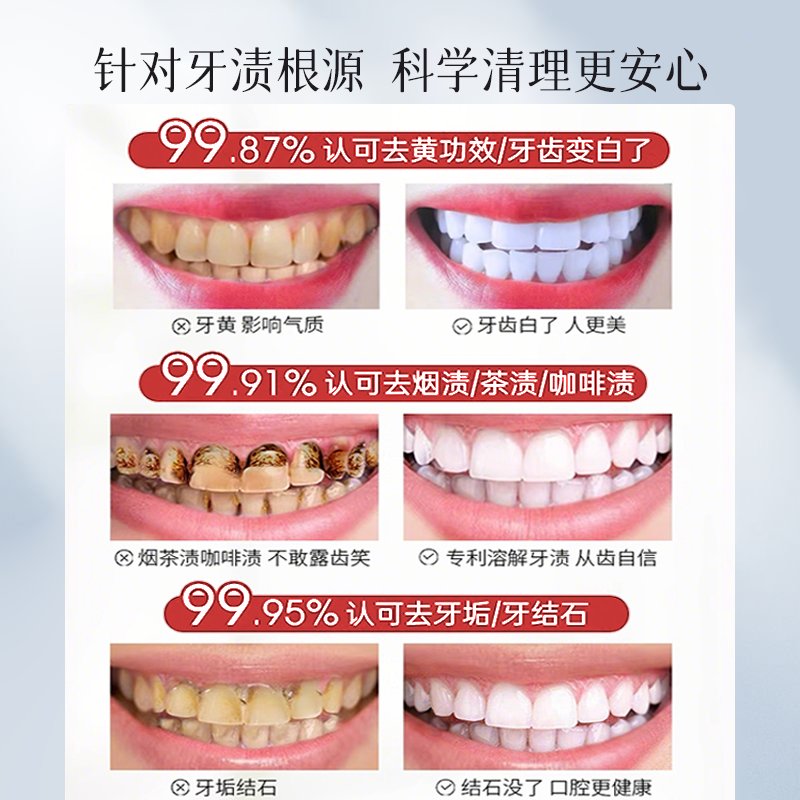 医用级洁牙粉：告别黄牙、清洁结石，让你的牙齿重获新生！