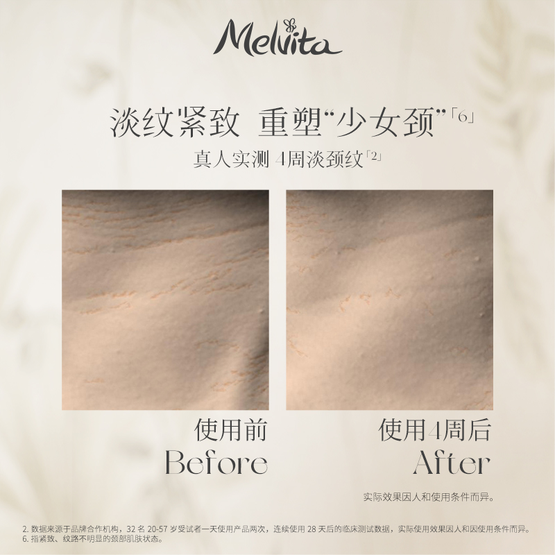 40岁的人大概有几道颈纹？宝藏干货，手把手教你科学抗老！