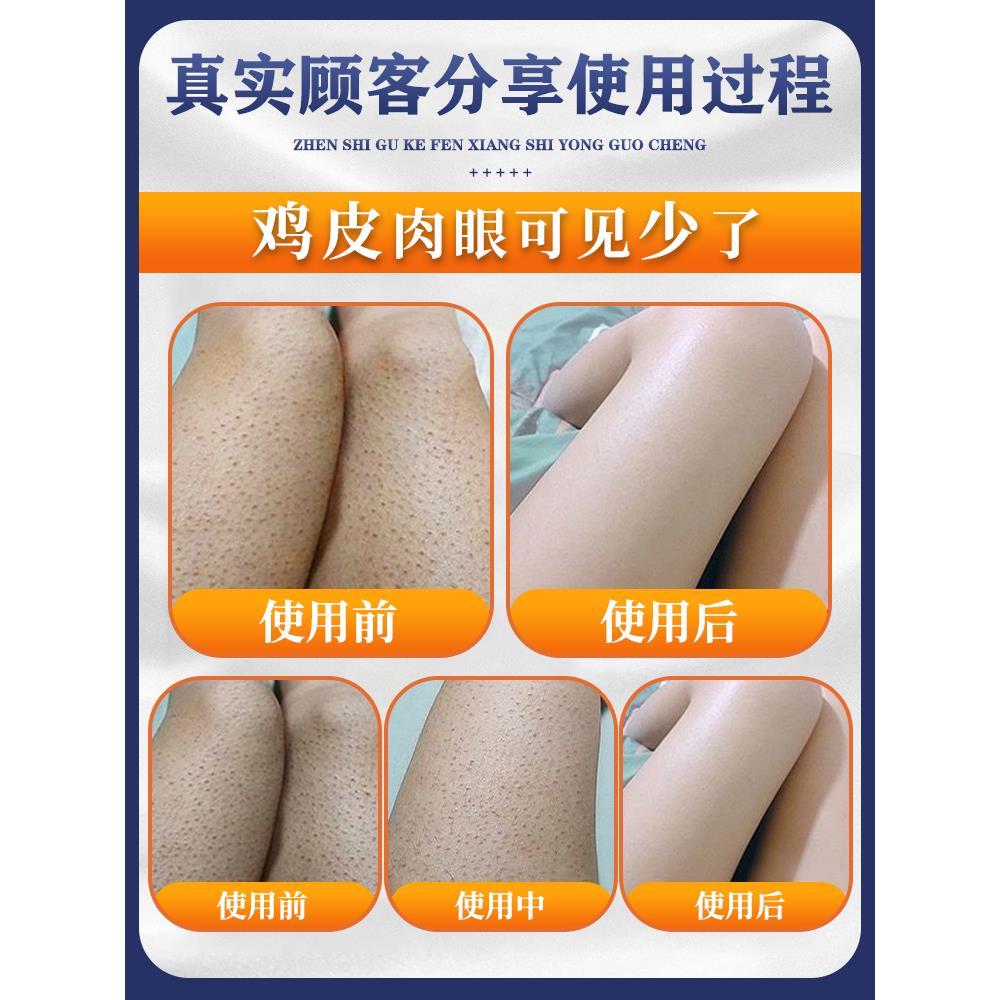 破解肌肤暗沉谜团！一小块皮肤粗糙像磨砂发黑？教科书级护肤秘籍来啦！