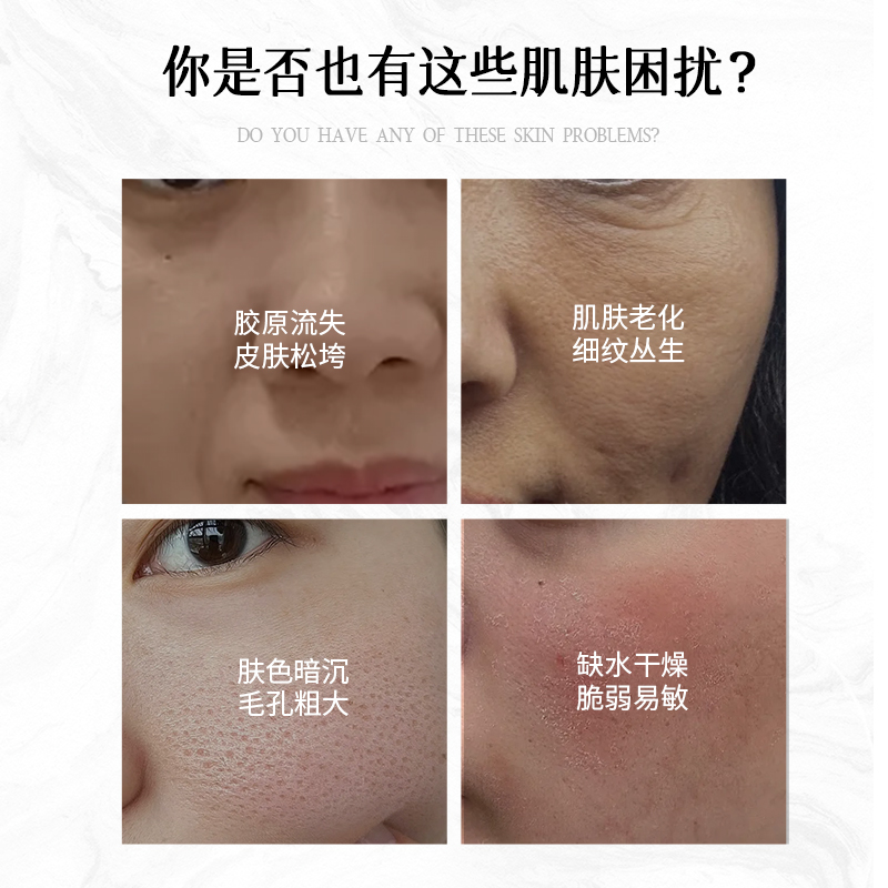 脐带充间质细胞外泌体：逆龄修复的秘密武器，冻龄原液大揭秘！