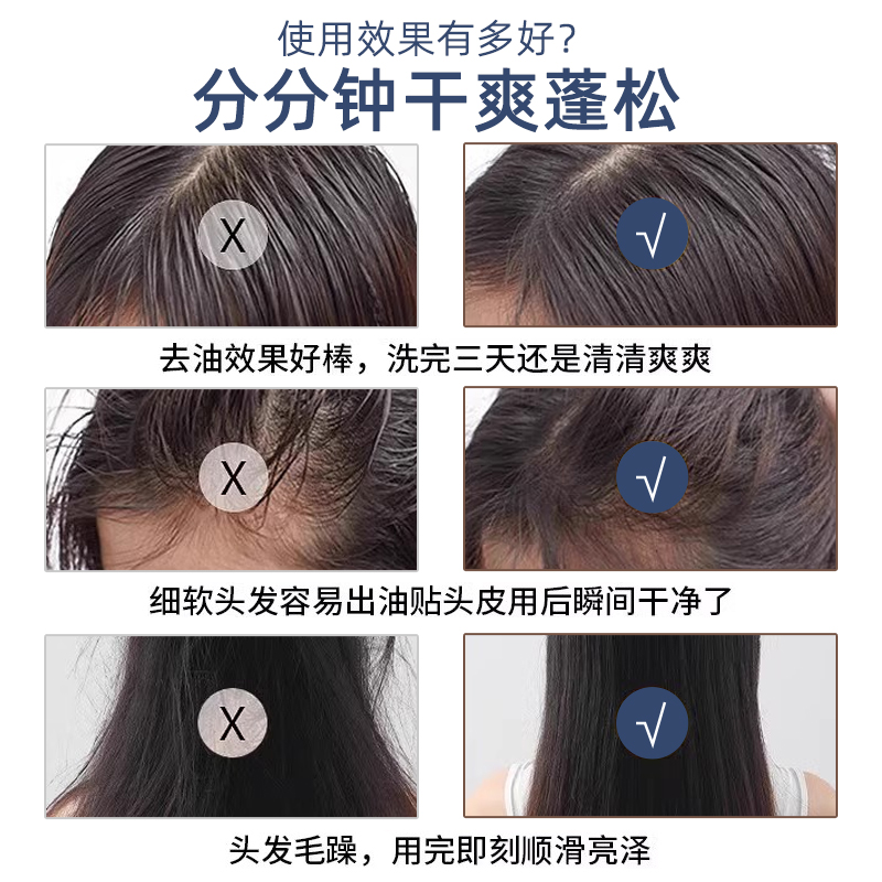 babycare五子棋跳棋中国象棋多合一儿童版飞行棋：孩子的智慧乐园，家长的安心之选！
