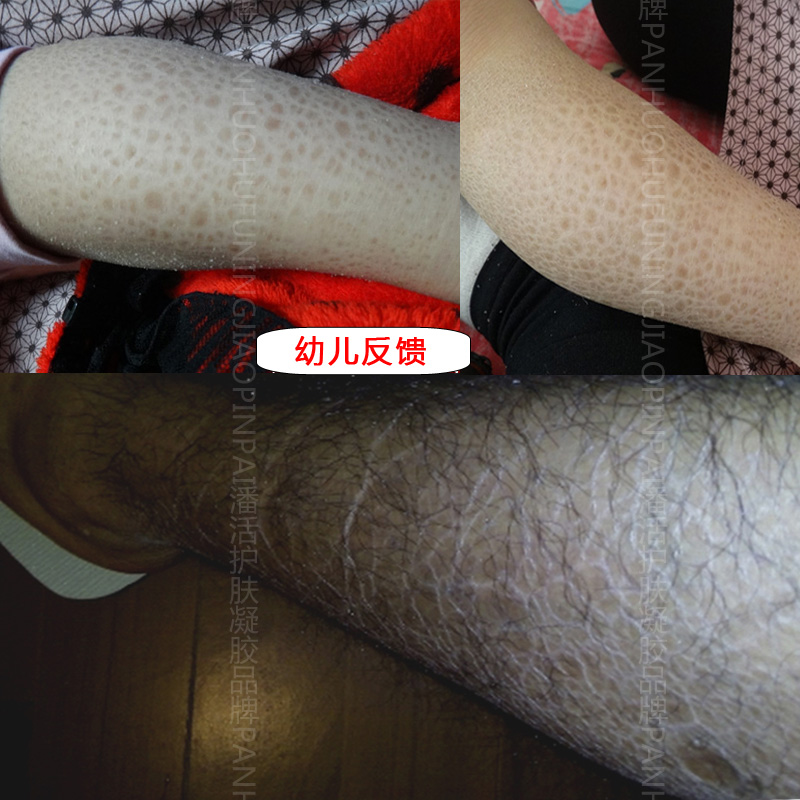 乳液灌肤正确使用方法：宝藏护肤指南，拒绝皮肤焦虑！